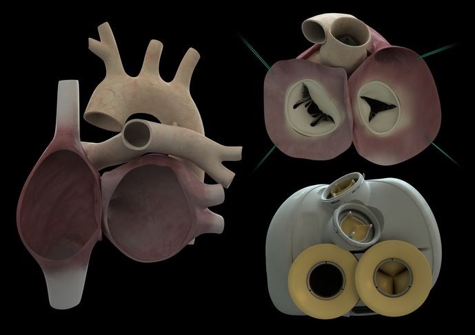 4339215_6_d401_ill-4339215-c40e-parts-of-heart_bf4eef64fa85df06eb97bb4fd378af38