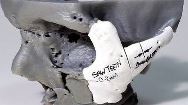 _73523858_skull