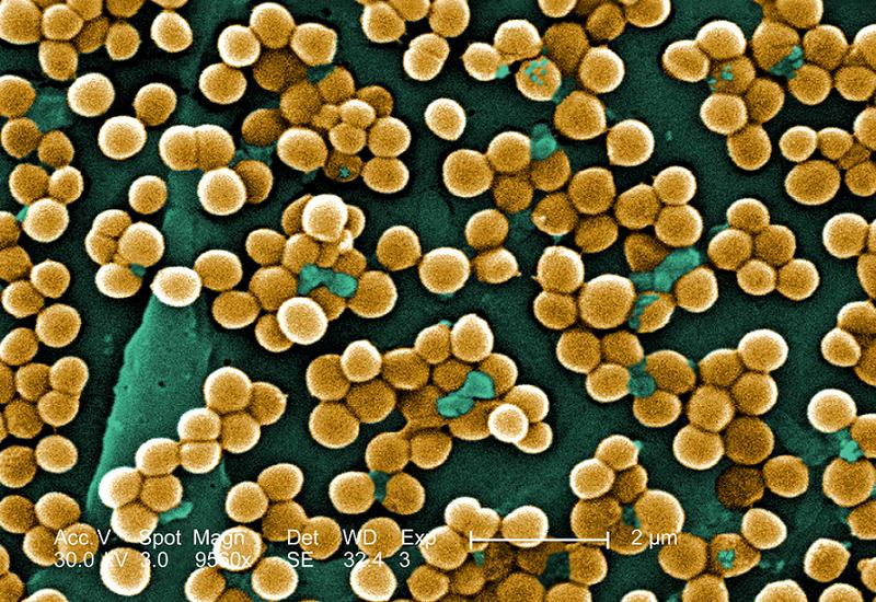 scary-diseases-mrsa
