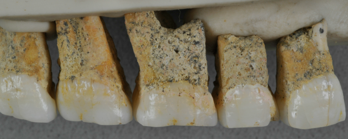  homo-luzonensis-teeth-banner-l 