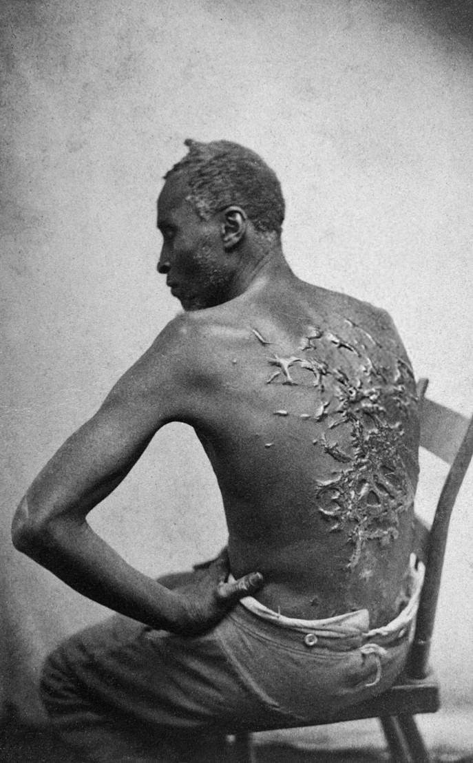 Scourged_back_by_McPherson_&_Oliver,_1863,_retouched 