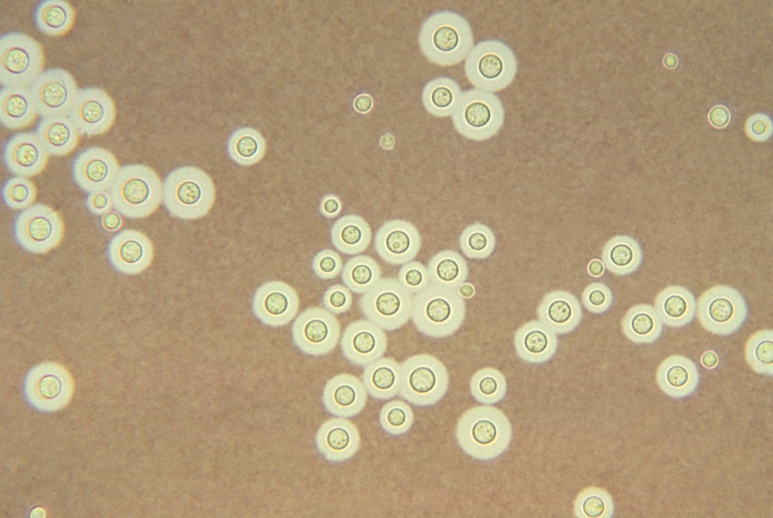 1280px-Cryptococcus_neoformans_using_a_light_India_ink_staining_preparation_PHIL_3771_lores