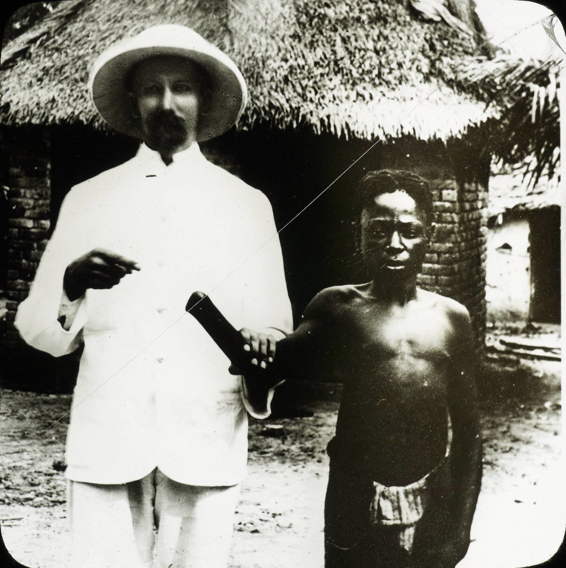  Victim_of_Congo_atrocities,_Congo,_ca._1890-1910_(IMP-CSCNWW33-OS10-19) 