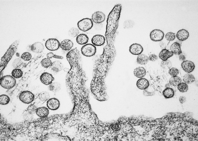  Sin_Nombre_hanta_virus_TEM_PHIL_1136_lores 