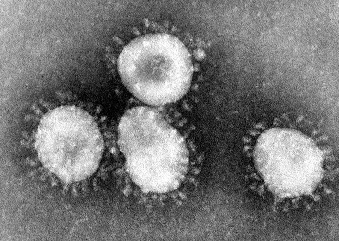 Жената, която открива първия човешки коронавирус, е дъщеря на шотландски